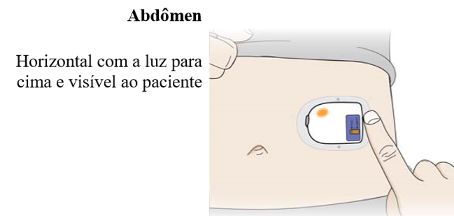 Abdomen OBI.png