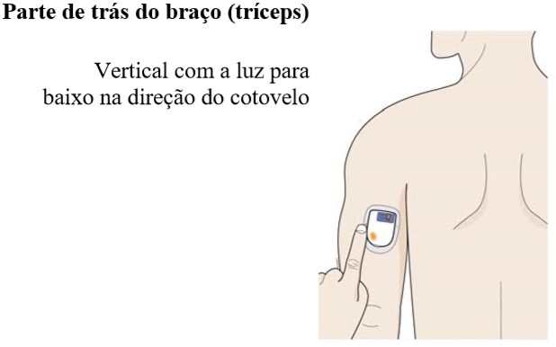 Braco OBI.png
